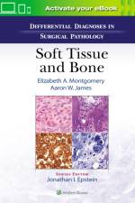 Differential Diagnoses in Surgical Pathology: Soft Tissue and Bone