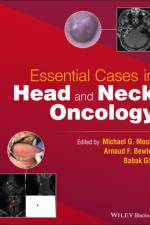 Essential Cases in Head and Neck Oncology af B Givi