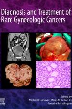 Diagnosis and Treatment of Rare Gynecologic Cancers af Michael (Professor Frumovitz