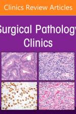 Breast Pathology, An Issue of Surgical Pathology Clinics af Kimberly H. Allison