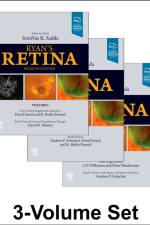 Ryan's Retina