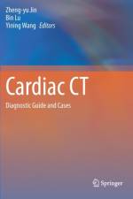 Cardiac CT