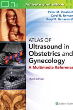 Atlas of Ultrasound in Obstetrics and Gynecology af Peter M. Doubilet
