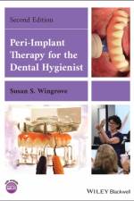 Peri-Implant Therapy for the Dental Hygienist af Susan S. (The Implant Consortium Wingrove