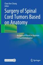 Surgery of Spinal Cord Tumors Based on Anatomy
