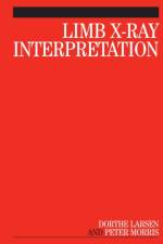 Limb X-Ray Interpretation af Dorthe (University Hospital Lewisham Larsen