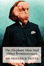 The Elephant Man And Other Reminiscences af Sir Frederick Treves