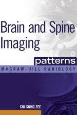 Brain and Spine Imaging Patterns af Chi-Shing Zee