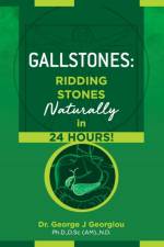 Gallstones af George John Georgiou