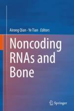 Noncoding RNAs and Bone