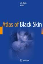 Atlas of Black Skin