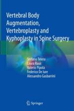 Vertebral Body Augmentation, Vertebroplasty and Kyphoplasty in Spine Surgery af Stefano Telera