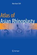 Atlas of Asian Rhinoplasty af Man Koon SUH