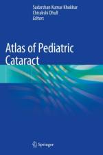 Atlas of Pediatric Cataract