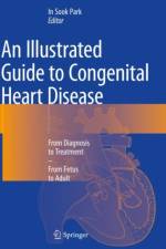 An Illustrated Guide to Congenital Heart Disease