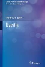 Uveitis