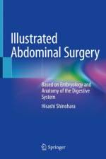 Illustrated Abdominal Surgery af Hisashi Shinohara