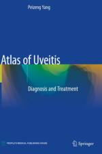 Atlas of Uveitis af Peizeng Yang