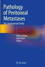 Pathology of Peritoneal Metastases