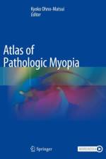 Atlas of Pathologic Myopia