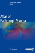 Atlas of Pathologic Myopia
