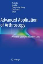 Advanced Application of Arthroscopy
