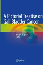 A Pictorial Treatise on Gall Bladder Cancer