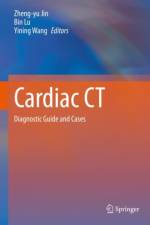 Cardiac CT