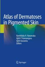 Atlas of Dermatoses in Pigmented Skin
