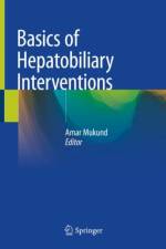 Basics of Hepatobiliary Interventions