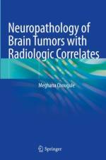 Neuropathology of Brain Tumors with Radiologic Correlates af Meghana Chougule