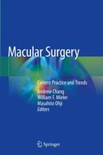Macular Surgery