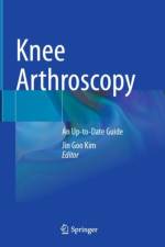 Knee Arthroscopy