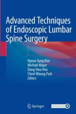 Advanced Techniques of Endoscopic Lumbar Spine Surgery