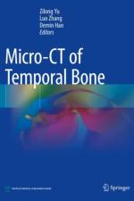Micro-CT of Temporal Bone
