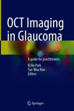 OCT Imaging in Glaucoma