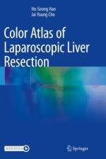 Color Atlas of Laparoscopic Liver Resection af Ho-Seong Han