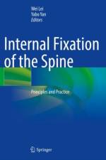 Internal Fixation of the Spine