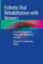 Esthetic Oral Rehabilitation with Veneers