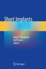 Short Implants