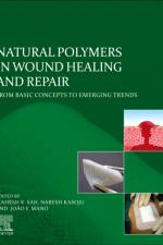 Natural Polymers in Wound Healing and Repair