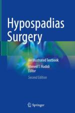 Hypospadias Surgery