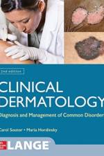 Clinical Dermatology: Diagnosis and Management of Common Disorders, Second Edition af Carol Soutor