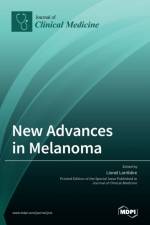 NEW ADVANCES IN MELANOMA af LIONEL LARRIB ERE