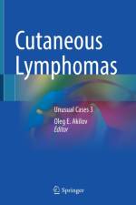 Cutaneous Lymphomas