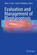 Evaluation and Management of Blepharoptosis af Adam J. Cohen