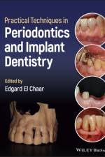 Practical Techniques in Periodontics and Implant Dentistry af E El Chaar