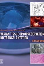 Principles and Practice of Ovarian Tissue Cryopreservation and Transplantation