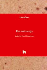 Dermatoscopy af Pawe¿ Pietkiewicz