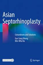 Asian Septorhinoplasty af Min-Wha Na